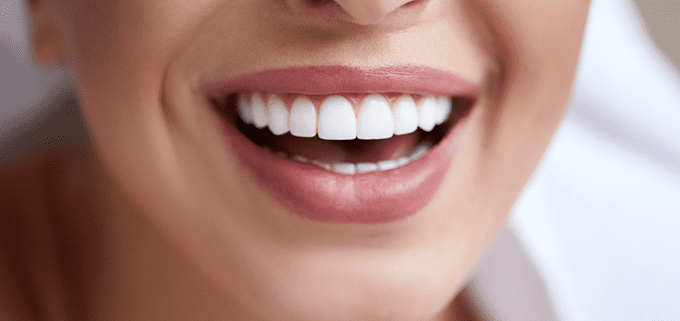 Diseño de sonrisa: qué es y qué tipos hay - clinicasgallut.com