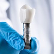 Beneficio de los implantes dentales
