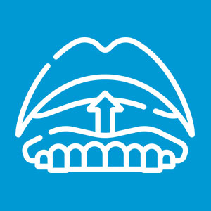 dentadura sobre implantes dentales
