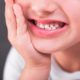 3 Hábitos infantiles que pueden incentivar el uso de ortodoncia