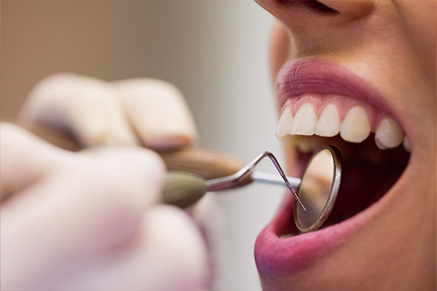 Principales consecuencias del verano en tu salud bucodental