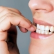 Morderse-las-uñas-daña-a-tus-dientes