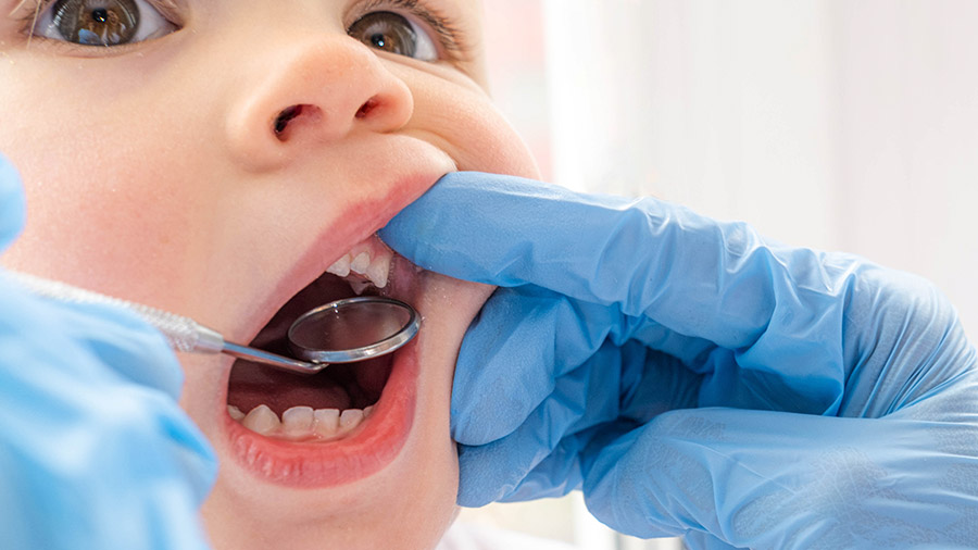 Elige-un-dentista-con-experiencia-en-niños
