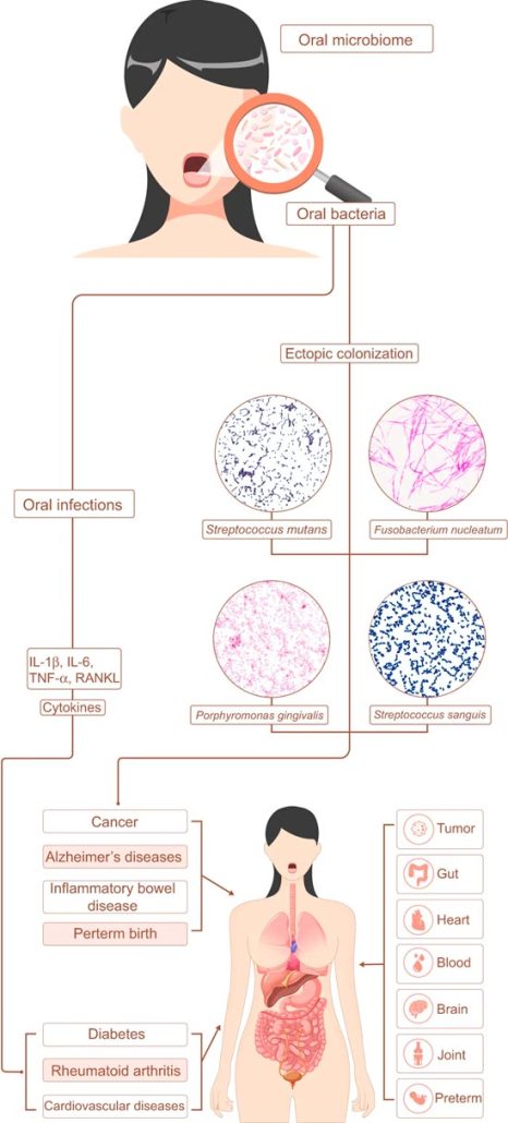 relacion microbiota oral y enfermedades