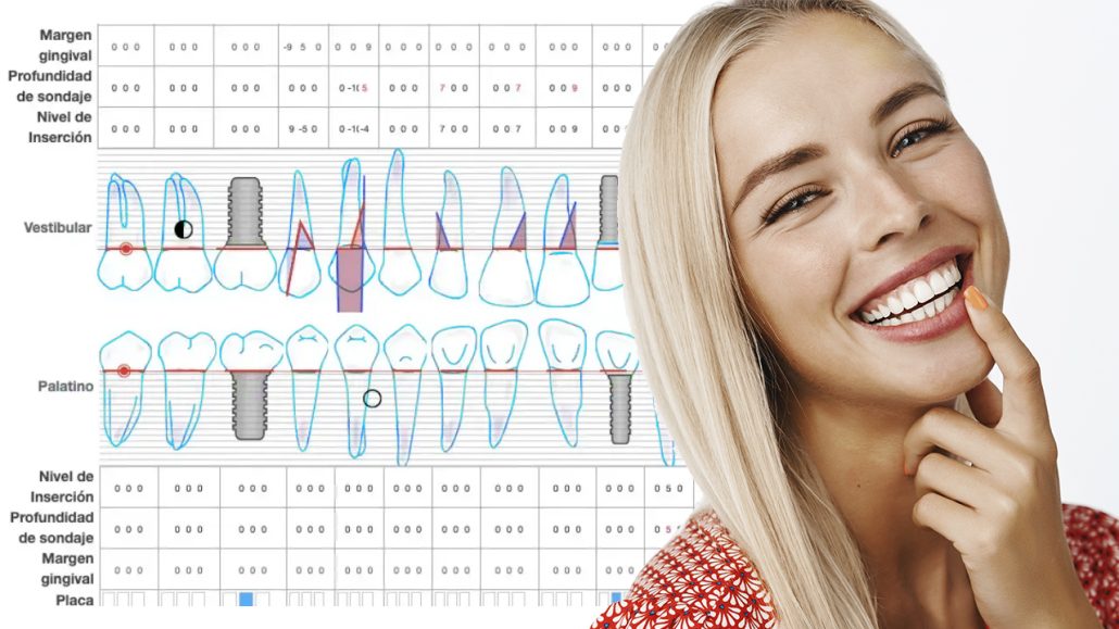 periodontograma