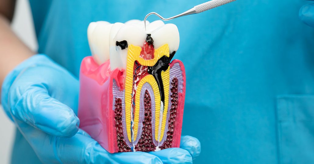 Endodoncia 1