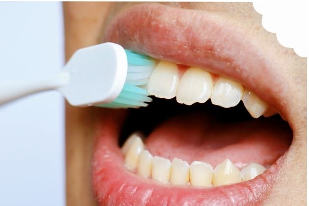 dientes con sarro dental