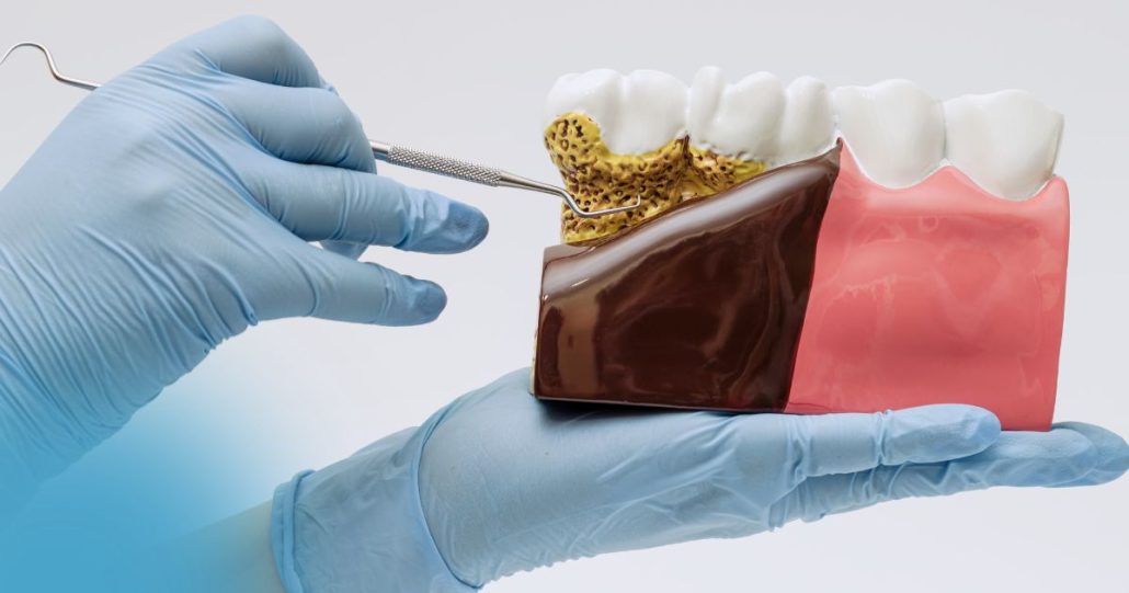 sarro dental